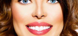 woman smiling after a Corner Mouth Lip Lift